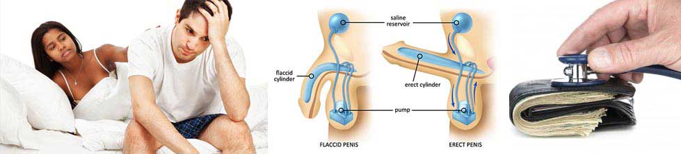 Penile Implant Surgery in India Cost